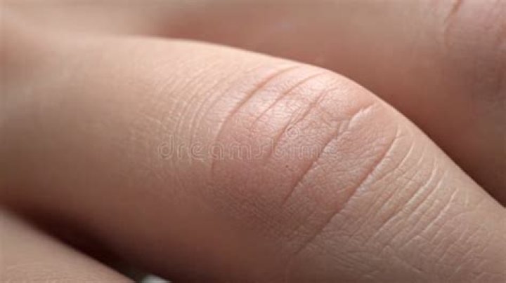 Finger, Grass, Skin, Joint, Human leg, Pink, Thigh, Muscle, Thumb, Grass family, 
