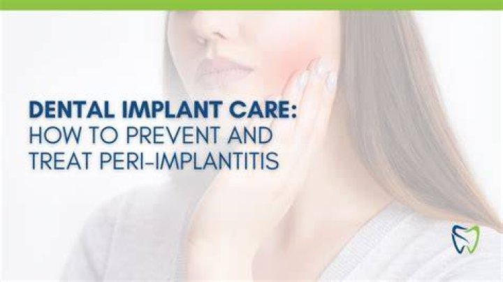 How Do We Treat Peri-implantitis? (Solution)