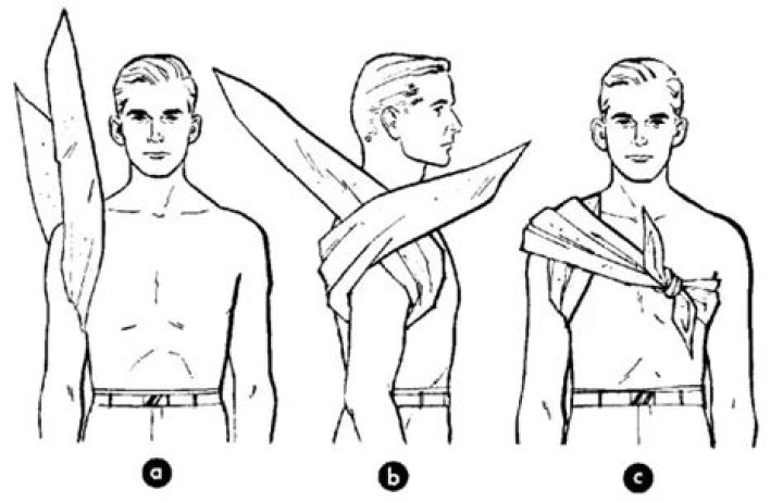 How do you cravat a bandaging?