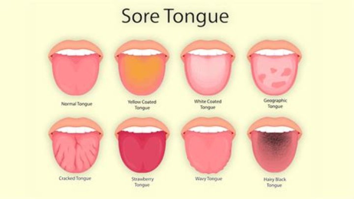 How Does Hot Sauce Affect The Tongue?