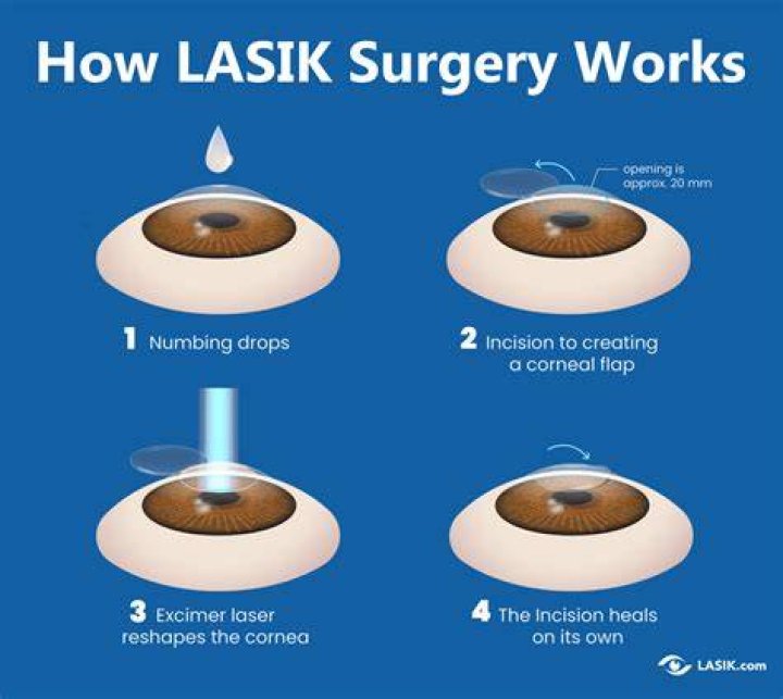 How Does Peri-aeriolar Surgery Work? (Correct answer)