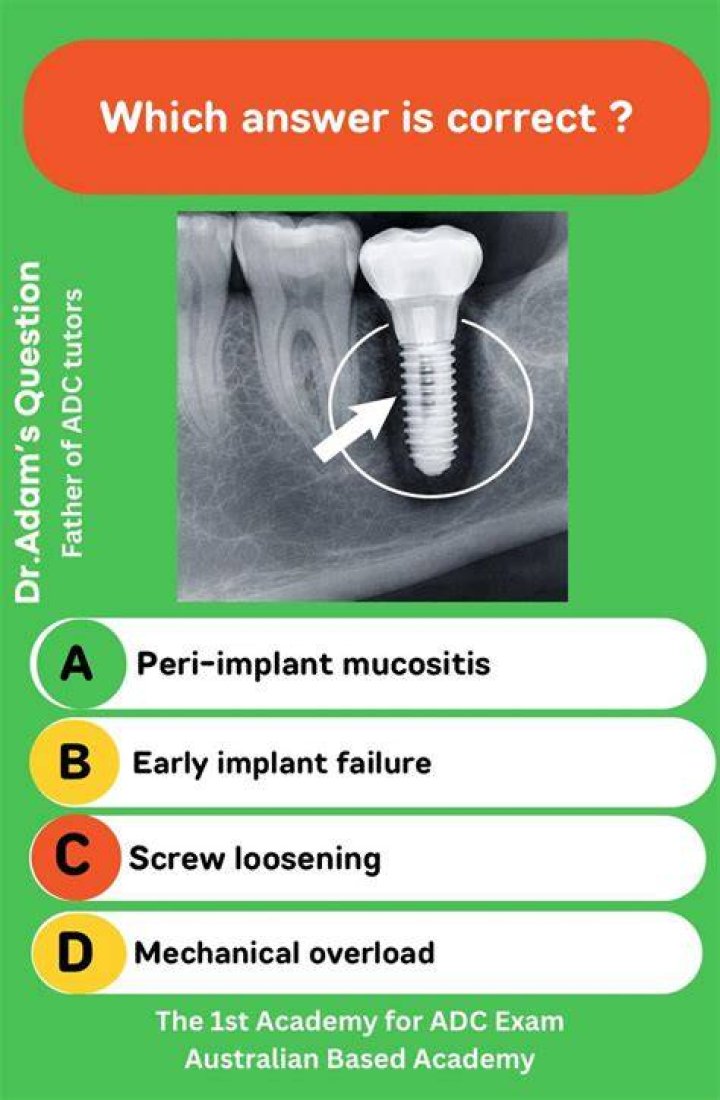 What Is Peri Dental? (Question)