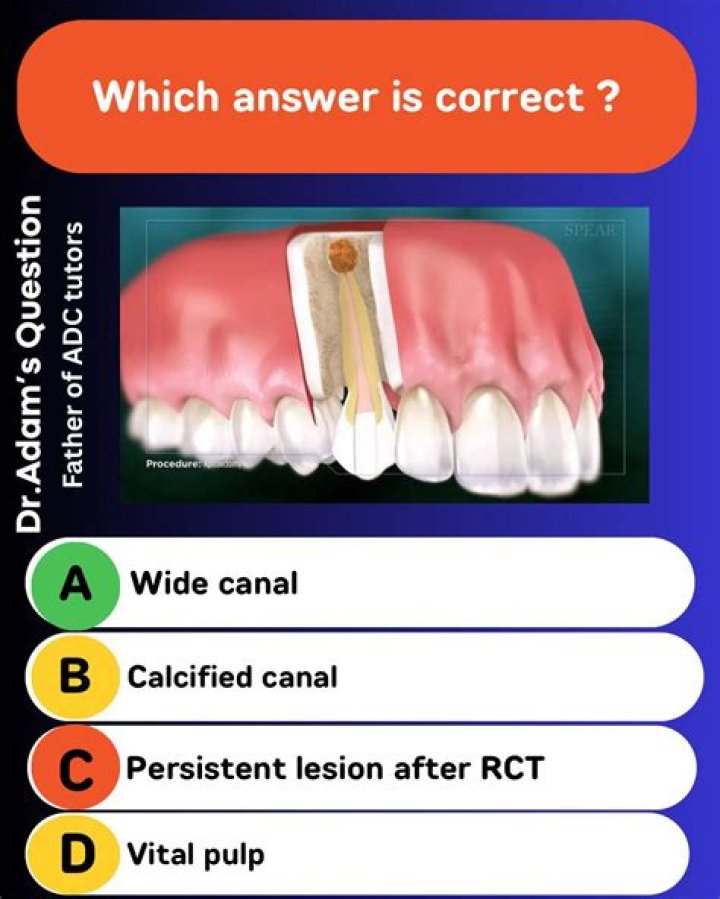 What Is Peri Lesion? (Correct answer)