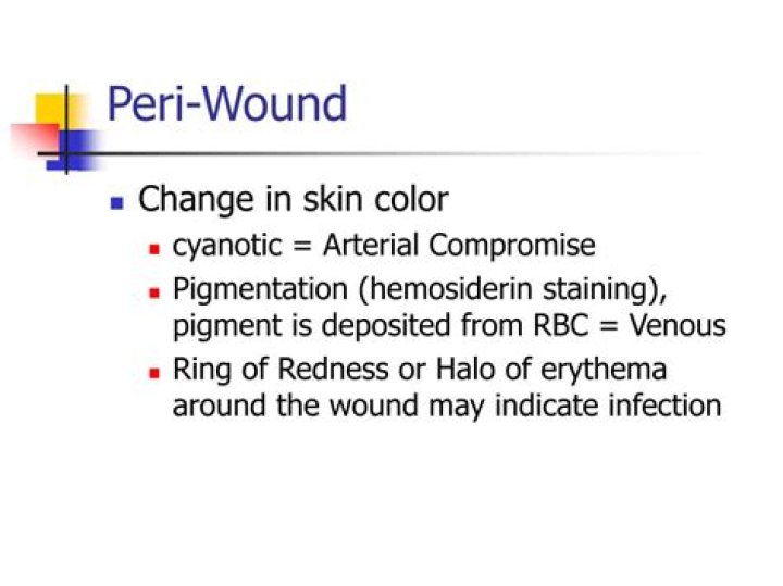 What Is Peri Wound Skin? (Solution found)