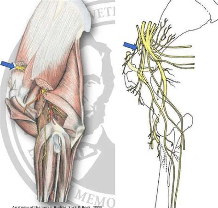 What Nerves Make Up The Peri? (Solved)